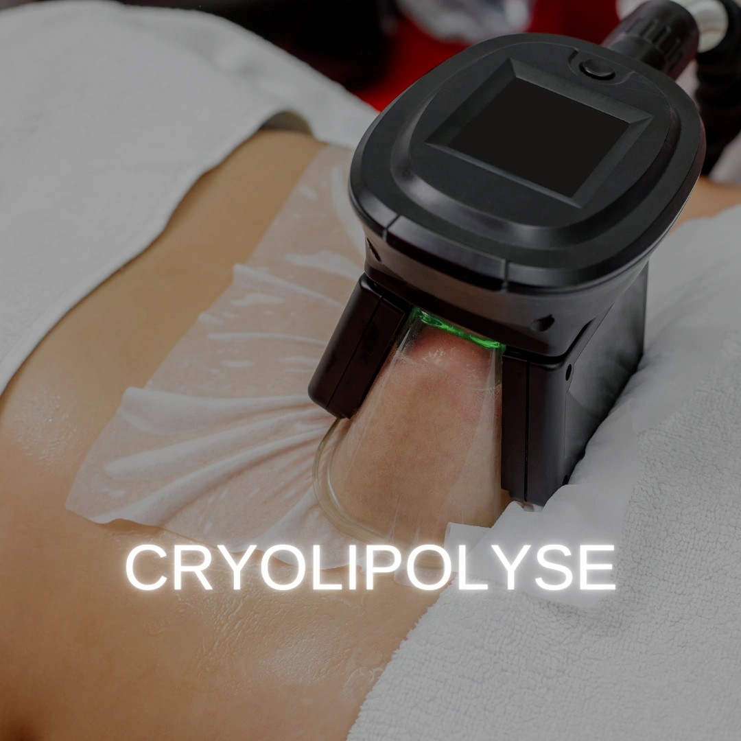 cryolipolyse à chavenay