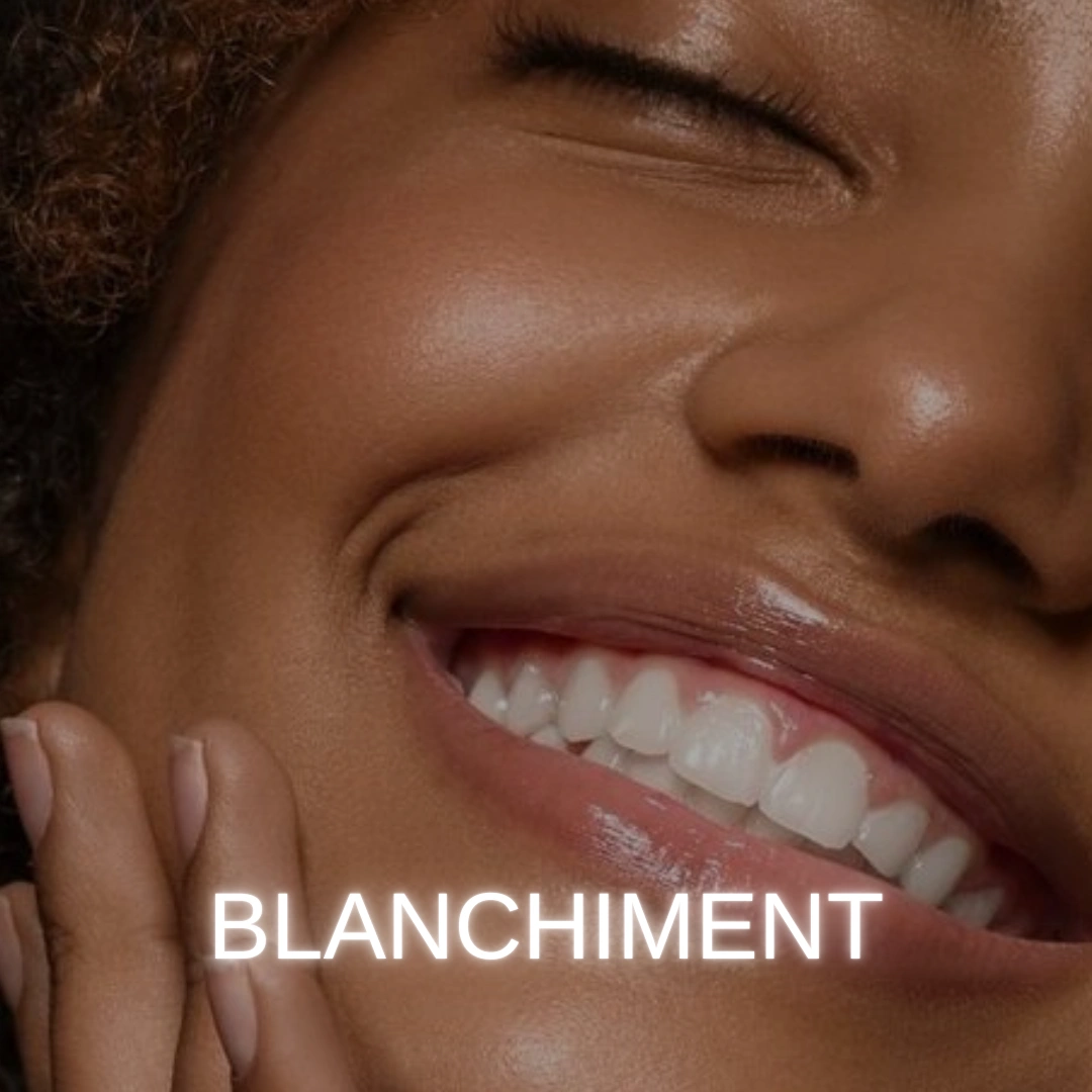 blanchiment dentaire à chavenay