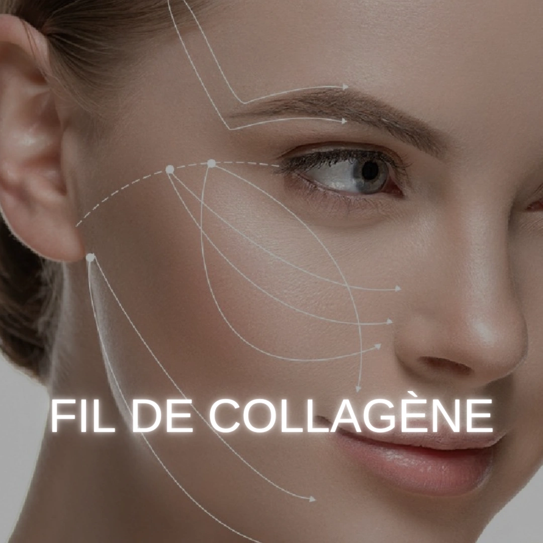 fil de collagène à chavenay