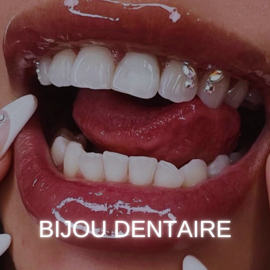 bijou dentaire à chavenay