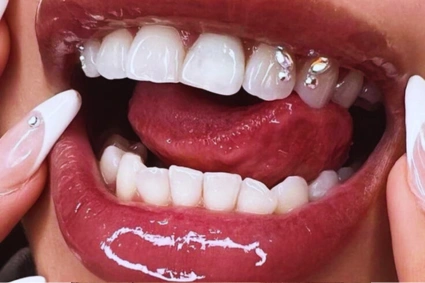 formation bijou dentaire à chavenay