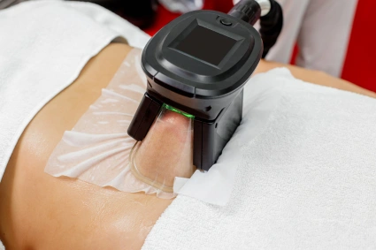 28 Formation cryolipolyse à Chavenay